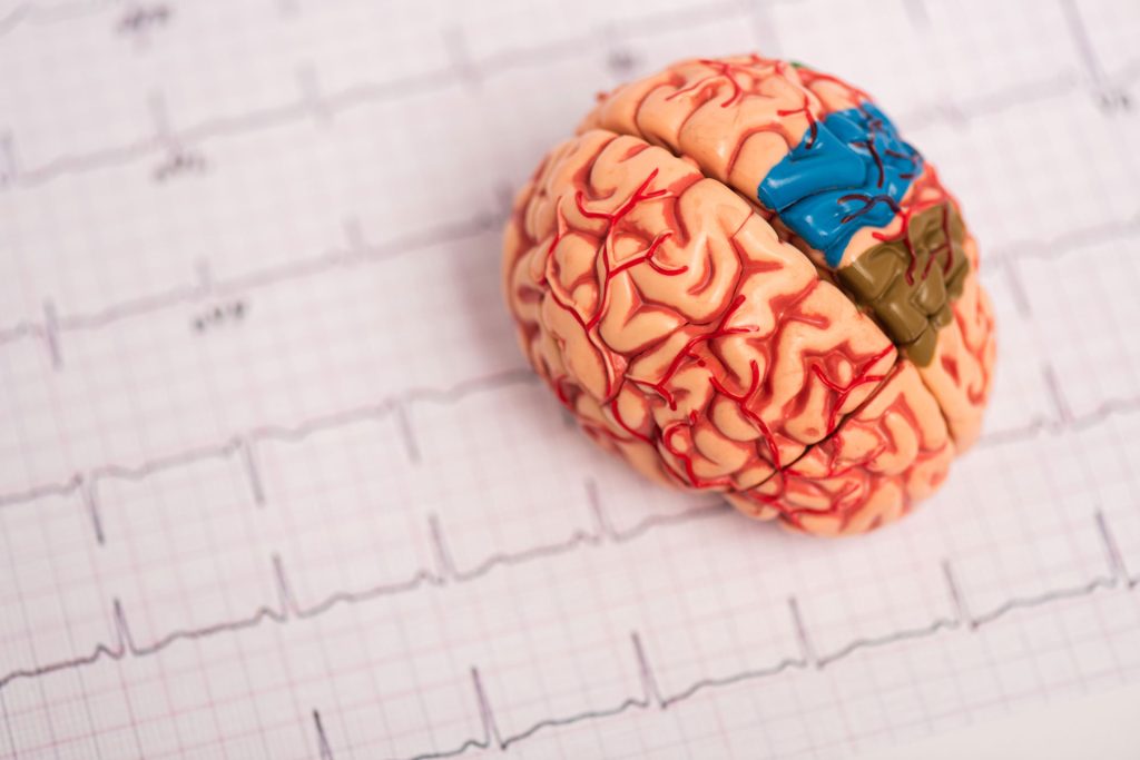 Selective focus of brain model.